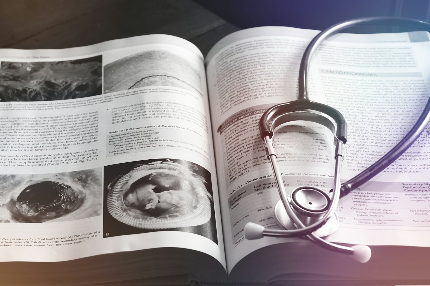 Medical textbook with heart diagrams and stethoscope.