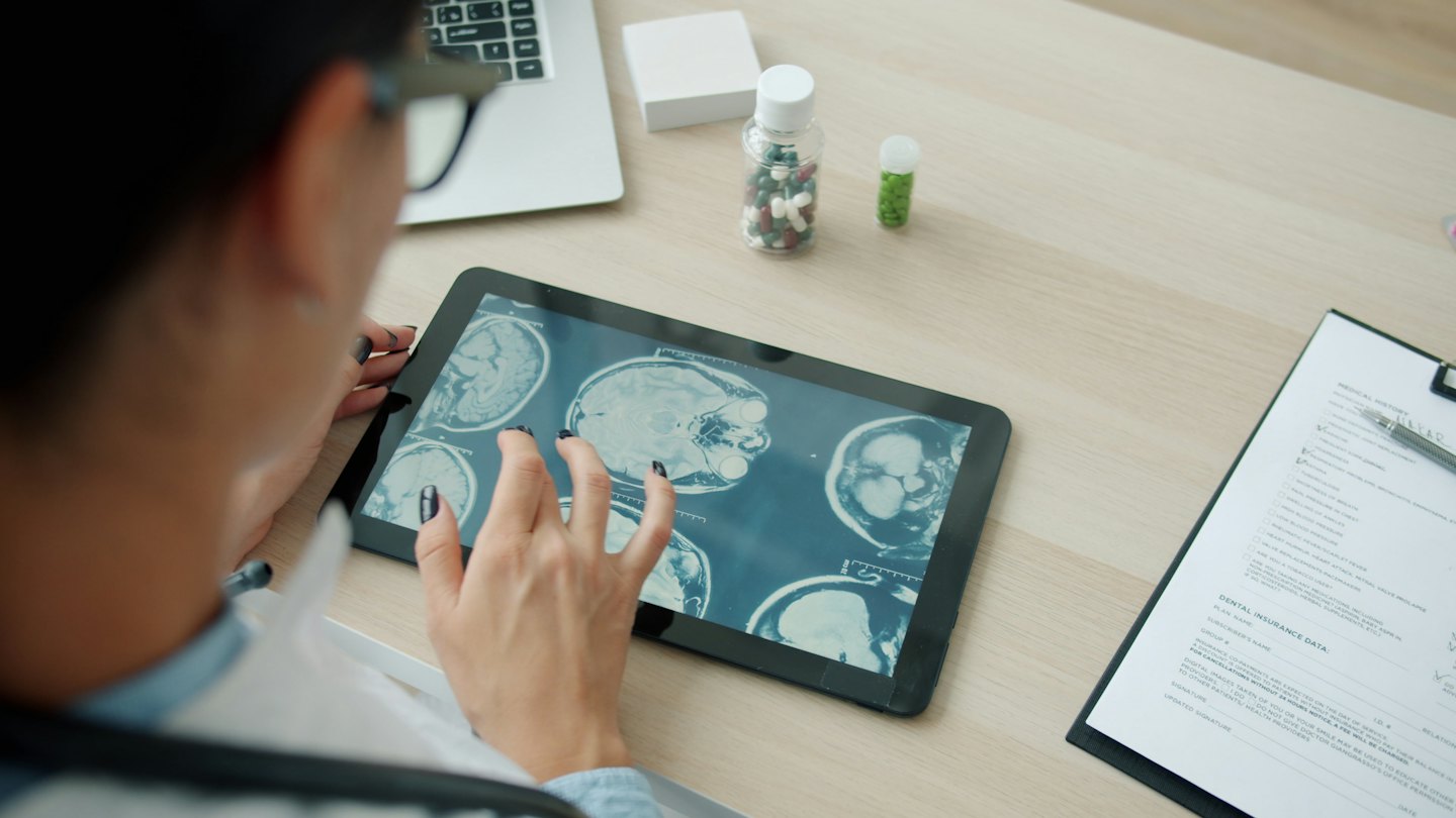 Doctor reviewing brain scans on a tablet at a desk.